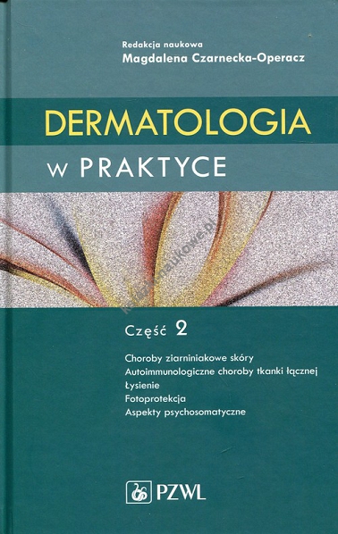 Dermatologia w praktyce Część 2