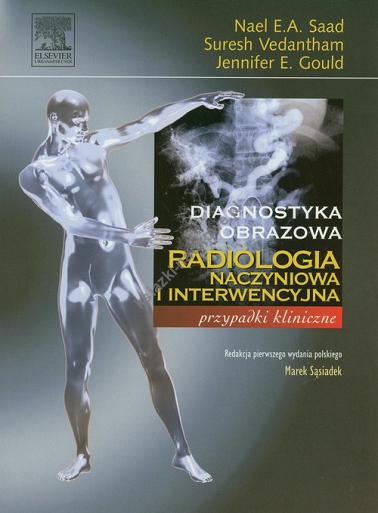 Radiologia naczyniowa i interwencyjna