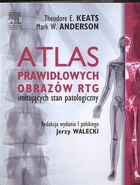 Atlas prawidłowych  obrazów RTG imitujących stan patologiczny