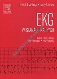 EKG w stanach nagłych