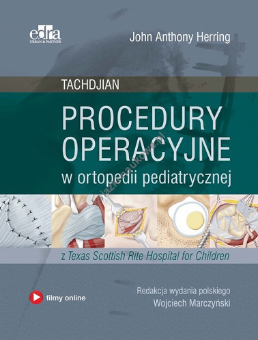 Procedury operacyjne w ortopedii pediatrycznej. Tachdjian