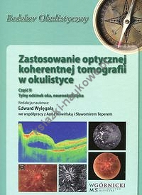 Zastosowanie optycznej koherentnej tomografii w okulistyce Część 2