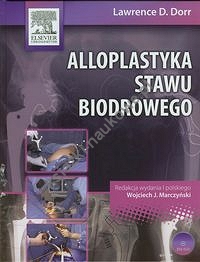 Alloplastyka stawu biodrowego z płytą DVD